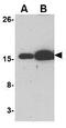 BCL2 Like 11 antibody, GTX84981, GeneTex, Western Blot image 