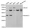 NADPH Oxidase 4 antibody, abx001813, Abbexa, Western Blot image 