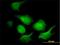 Adenylate Kinase 1 antibody, H00000203-M01, Novus Biologicals, Immunofluorescence image 