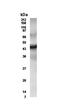 CUGBP Elav-Like Family Member 2 antibody, NB600-204, Novus Biologicals, Western Blot image 