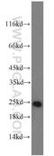 ATP Synthase Peripheral Stalk Subunit OSCP antibody, 10994-1-AP, Proteintech Group, Western Blot image 