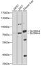 Solute Carrier Family 39 Member 4 antibody, 19-072, ProSci, Western Blot image 