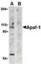 Apoptotic Peptidase Activating Factor 1 antibody, PA5-19893, Invitrogen Antibodies, Western Blot image 