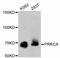 Protein Kinase C Alpha antibody, STJ112958, St John