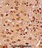 Mitogen-Activated Protein Kinase Kinase 7 antibody, abx027840, Abbexa, Immunohistochemistry paraffin image 