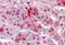 NDC80 Kinetochore Complex Component antibody, MBS242638, MyBioSource, Immunohistochemistry frozen image 