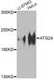 Autophagy Related 2A antibody, A10594, Boster Biological Technology, Western Blot image 