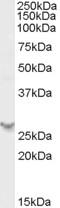 Proteasome Activator Subunit 2 antibody, orb19476, Biorbyt, Western Blot image 