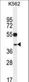 YOD1 Deubiquitinase antibody, LS-C160690, Lifespan Biosciences, Western Blot image 