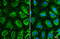 Chaperonin Containing TCP1 Subunit 5 antibody, GTX631668, GeneTex, Immunofluorescence image 