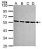 Proteasome 26S Subunit, Non-ATPase 4 antibody, PA5-30135, Invitrogen Antibodies, Western Blot image 