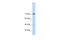 GTF2I Repeat Domain Containing 1 antibody, 27-931, ProSci, Western Blot image 