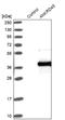 Ankyrin Repeat Domain 45 antibody, NBP1-85423, Novus Biologicals, Western Blot image 
