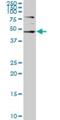 Serum/Glucocorticoid Regulated Kinase 2 antibody, H00010110-M05, Novus Biologicals, Western Blot image 