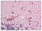 Ring Finger Protein 25 antibody, AP07632PU-N, Origene, Immunohistochemistry paraffin image 