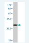 E3 ubiquitin-protein ligase HECTD1 antibody, H00025831-M08, Novus Biologicals, Western Blot image 