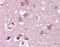 Reticulon 4 antibody, orb89462, Biorbyt, Immunohistochemistry paraffin image 