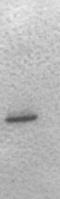 Interferon Alpha 2 antibody, ab9386, Abcam, Western Blot image 