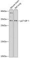 Cyclin Dependent Kinase Inhibitor 1B antibody, 16-151, ProSci, Western Blot image 
