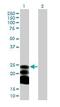 Bone Marrow Stromal Cell Antigen 2 antibody, ab88523, Abcam, Western Blot image 