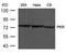 Eukaryotic Translation Initiation Factor 2 Alpha Kinase 2 antibody, A01384, Boster Biological Technology, Western Blot image 