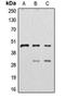 Cathepsin D antibody, orb213804, Biorbyt, Western Blot image 