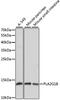 Phospholipase A2 Group IB antibody, GTX66466, GeneTex, Western Blot image 