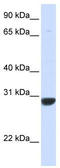 Pyridoxamine 5'-Phosphate Oxidase antibody, TA344305, Origene, Western Blot image 