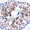 Signal Transducer And Activator Of Transcription 5A antibody, AP0139, ABclonal Technology, Immunohistochemistry paraffin image 