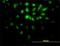 E2F Transcription Factor 6 antibody, H00001876-M02, Novus Biologicals, Immunocytochemistry image 