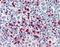 S100 Calcium Binding Protein A8 antibody, orb88499, Biorbyt, Immunohistochemistry paraffin image 