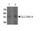 Solute Carrier Family 39 Member 14 antibody, ab106568, Abcam, Western Blot image 