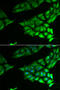 PSA antibody, STJ28790, St John