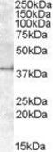 Apolipoprotein L6 antibody, GTX47586, GeneTex, Western Blot image 