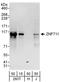 Zinc Finger Protein 711 antibody, A303-280A, Bethyl Labs, Western Blot image 