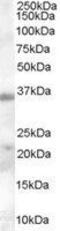 Hepatitis A Virus Cellular Receptor 2 antibody, GTX89379, GeneTex, Western Blot image 