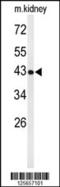 UBX Domain Protein 6 antibody, 61-785, ProSci, Western Blot image 