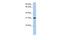 Dickkopf Like Acrosomal Protein 1 antibody, PA5-44099, Invitrogen Antibodies, Western Blot image 