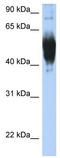 Lecithin-Cholesterol Acyltransferase antibody, TA346169, Origene, Western Blot image 