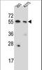 Copine 8 antibody, LS-C166998, Lifespan Biosciences, Western Blot image 
