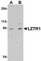 Leucine Zipper Like Transcription Regulator 1 antibody, A06363, Boster Biological Technology, Western Blot image 