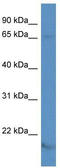 Potassium Voltage-Gated Channel Subfamily A Member 5 antibody, TA334713, Origene, Western Blot image 