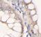 Denticleless E3 Ubiquitin Protein Ligase Homolog antibody, FNab10365, FineTest, Immunohistochemistry paraffin image 