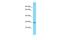 Olfactory receptor 872 antibody, A30196, Boster Biological Technology, Western Blot image 