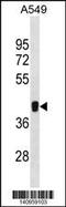 Makorin Ring Finger Protein 1 antibody, 60-673, ProSci, Western Blot image 