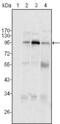 Staphylococcal Nuclease And Tudor Domain Containing 1 antibody, MA5-15420, Invitrogen Antibodies, Western Blot image 