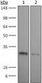 Thy-1 Cell Surface Antigen antibody, GTX14089, GeneTex, Western Blot image 