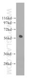 RAD23 Homolog A, Nucleotide Excision Repair Protein antibody, 11364-1-AP, Proteintech Group, Western Blot image 