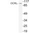 OCRL Inositol Polyphosphate-5-Phosphatase antibody, PA5-75370, Invitrogen Antibodies, Western Blot image 