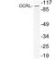 OCRL Inositol Polyphosphate-5-Phosphatase antibody, PA5-75370, Invitrogen Antibodies, Western Blot image 